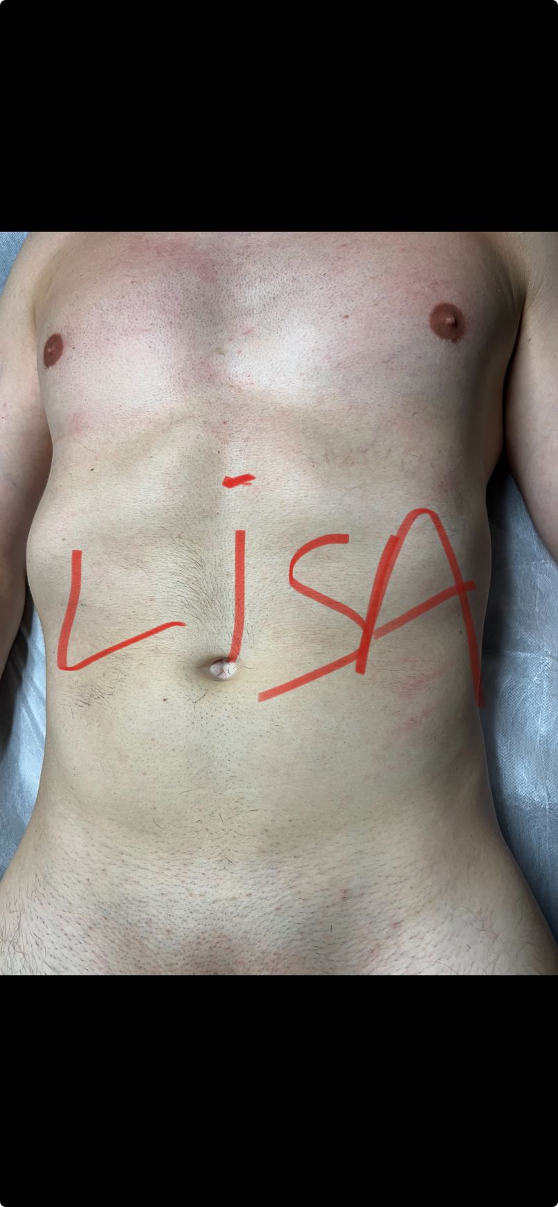 Lisa 11